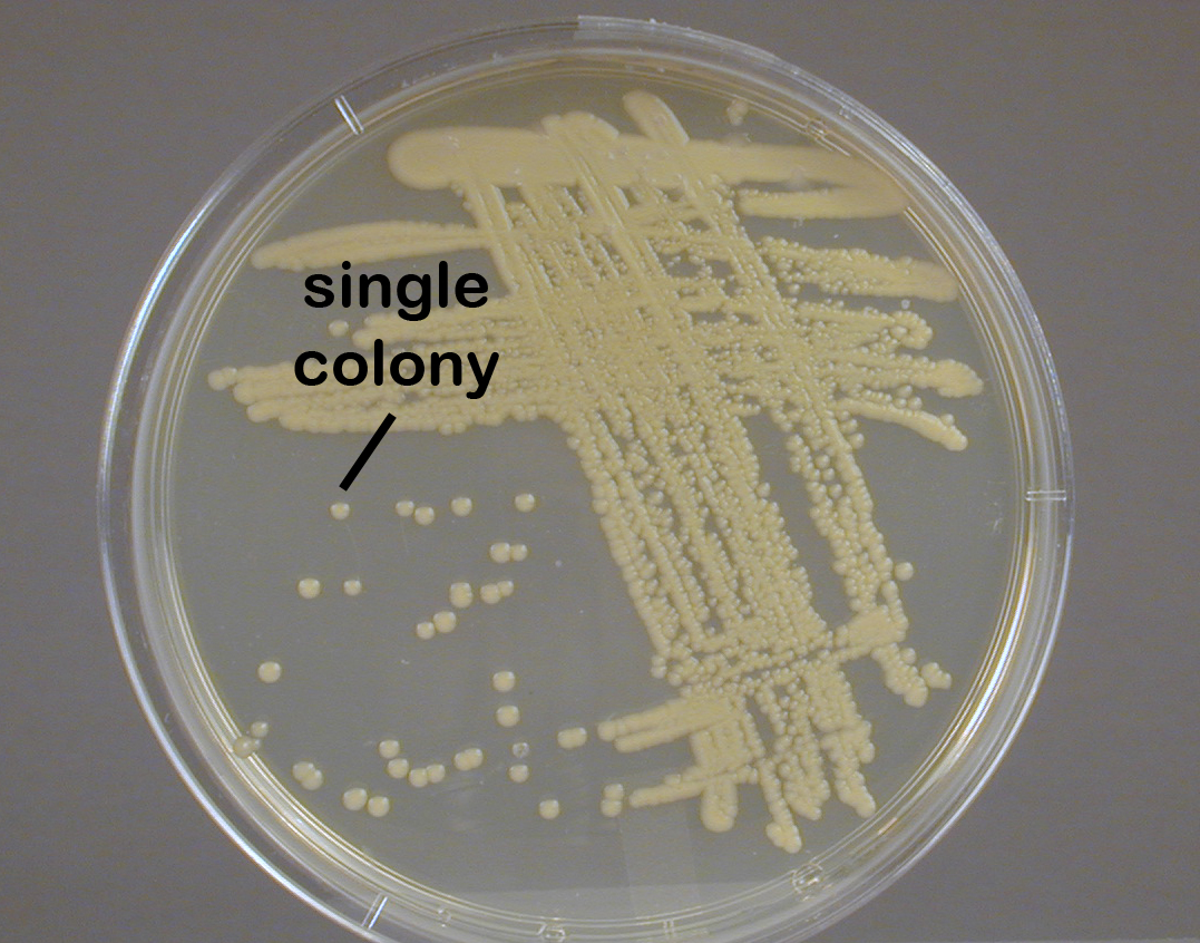 Photograph showing isolated colonies of <i>Micrococcus luteus</i>